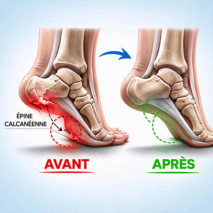 Chaussettes de compression